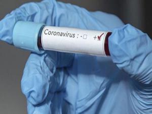 Türkiye'deki koronavirüs vakası İstanbul'da mı?