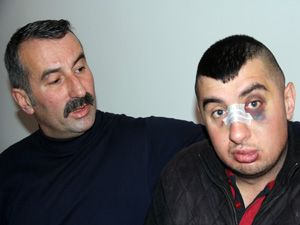 Erzurum'da zihinsel engelli genci döven serbest bırakıldı