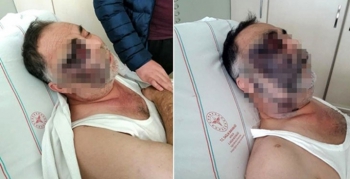 Engelli vatandaşı öldüresiye dövdüler!