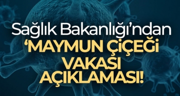 Sağlık Bakanlığı: Ülkemizde bugüne kadar 'maymun çiçeği' vakası görülmemiştir