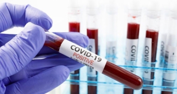 Yeni koronavirüs genelgesi: Hapis cezası geliyor