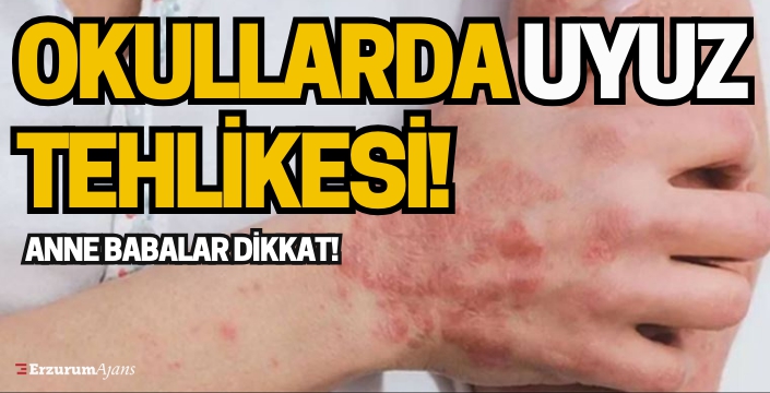 15 dakikada bulaşan uyuz hastalığının salgına dönüşmemesi için dikkat!