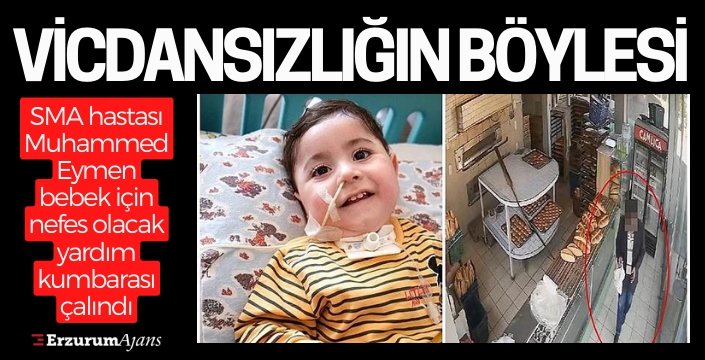 Erzurum'da SMA hastası bebeğin yardım kutusu çalındı