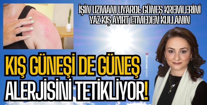 Güneş alerjisi sadece yazın görülmüyor!