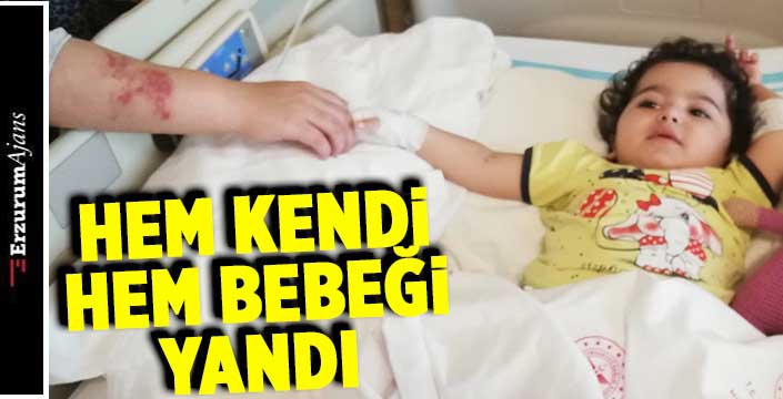 Minik Eslem ve annesi sıcak suyla haşlandı